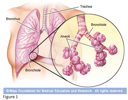 Asthma definition and treatment of asthma